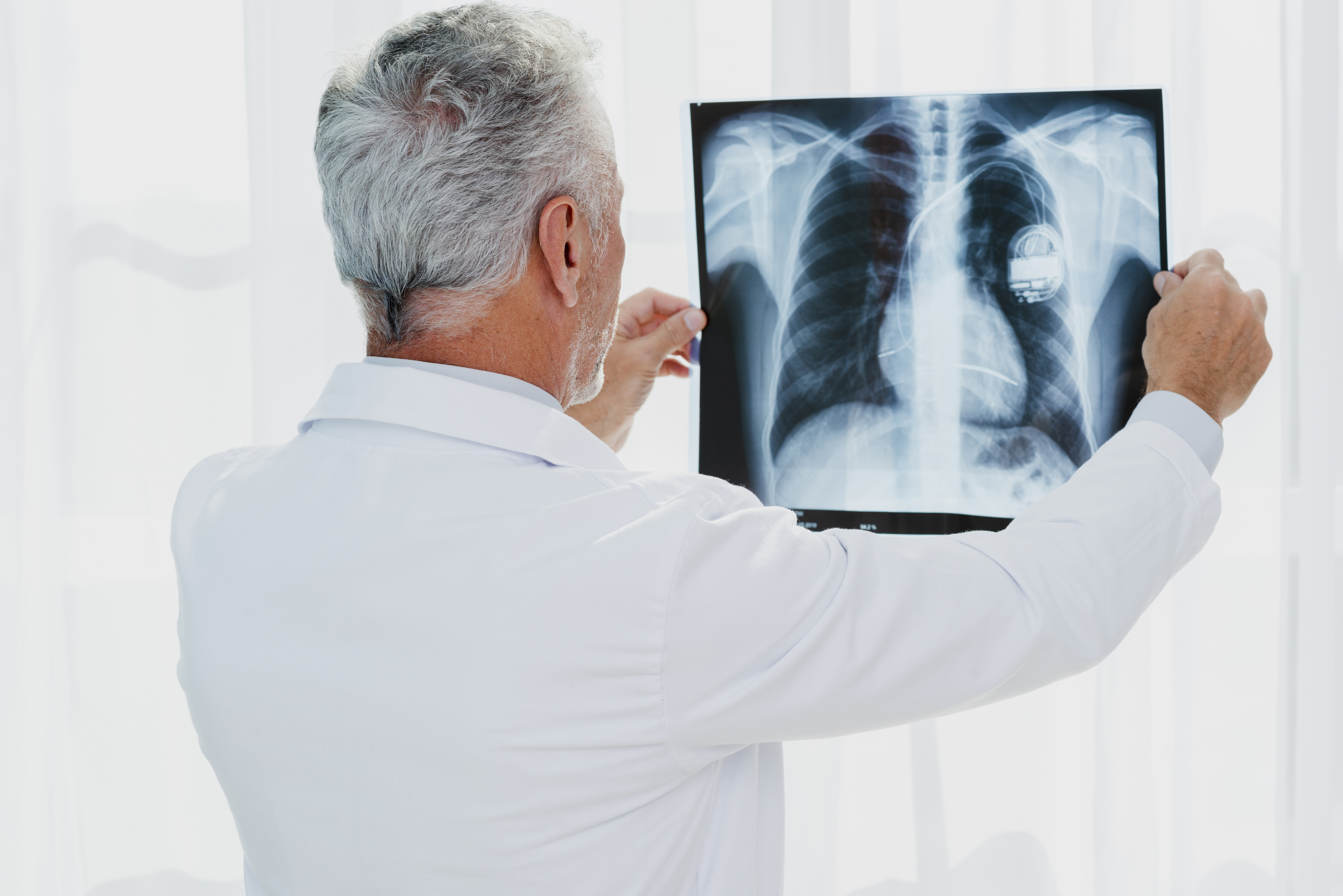 xray